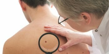 Seis signos cutáneos que te deben hacer consultar con un dermatólogo