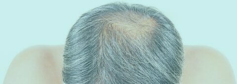 Clínica de Dermatología , Cirugía, Tricología y Depilación Láser