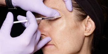 Botox en Córdoba